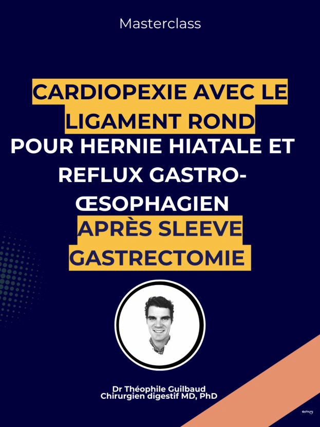 Cardiopexie avec le ligament rond chez un patient présentant hernie hiatale, reflux gastro-œsophagien et antécédent de sleeve gastrectomie