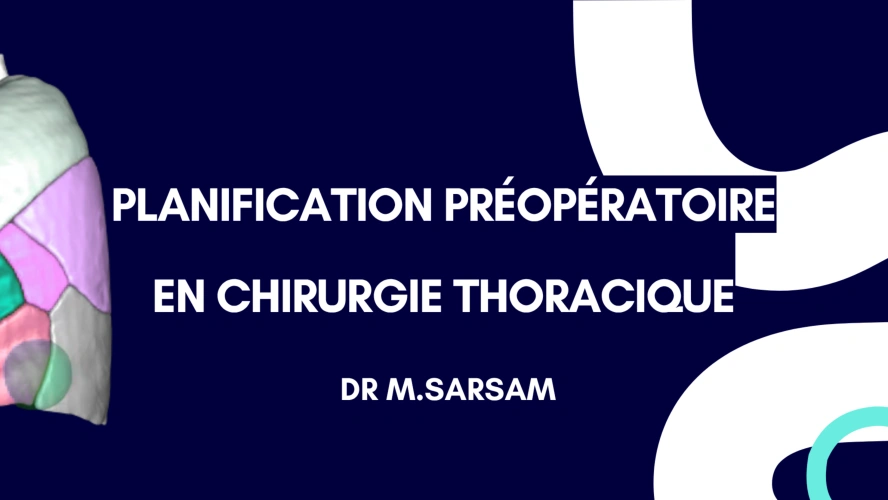 Planification 3D préopératoire en chirurgie thoracique