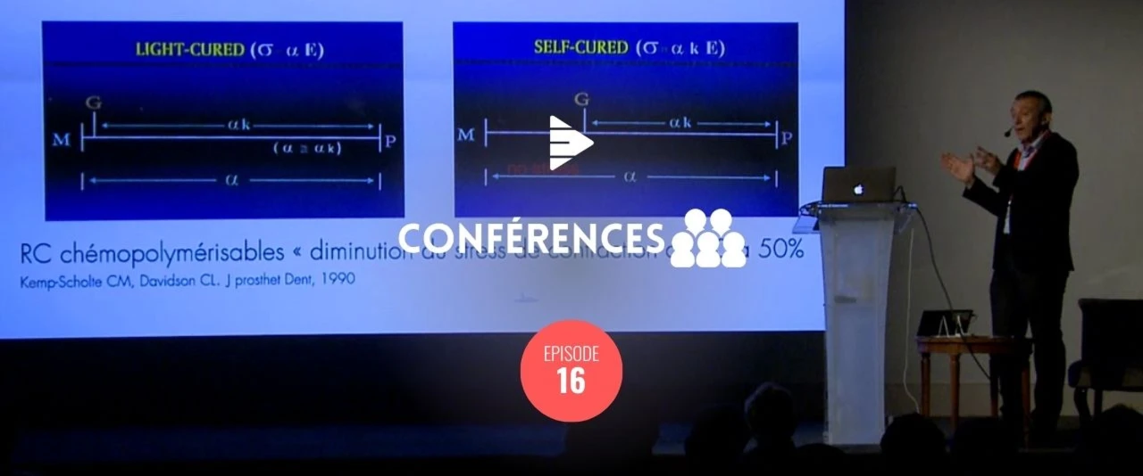 Restaurations postérieures directes