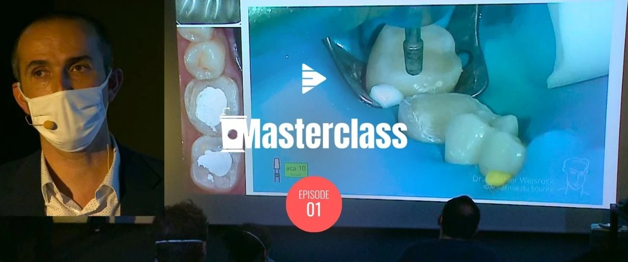 Inlay / Onlay Partie 1