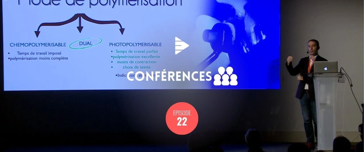 Les facettes en céramique