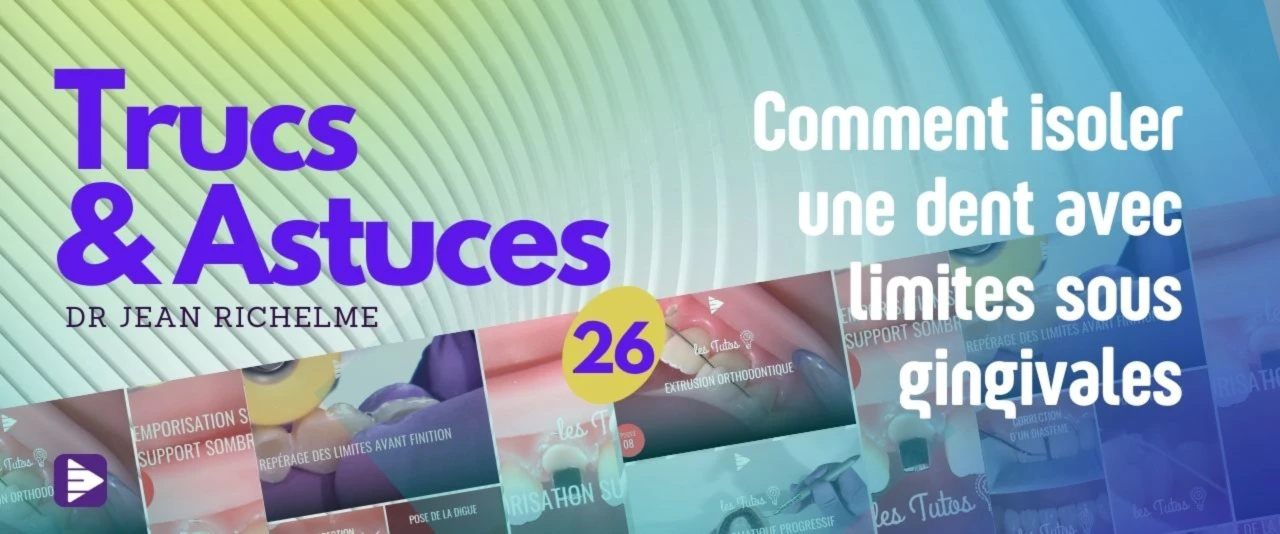 Trucs et astuces : Comment isoler une dent avec limites sous gingivales