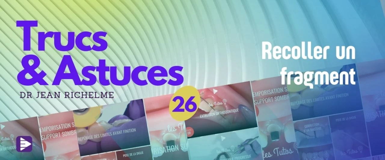 Trucs et astuces : Recoller un fragment