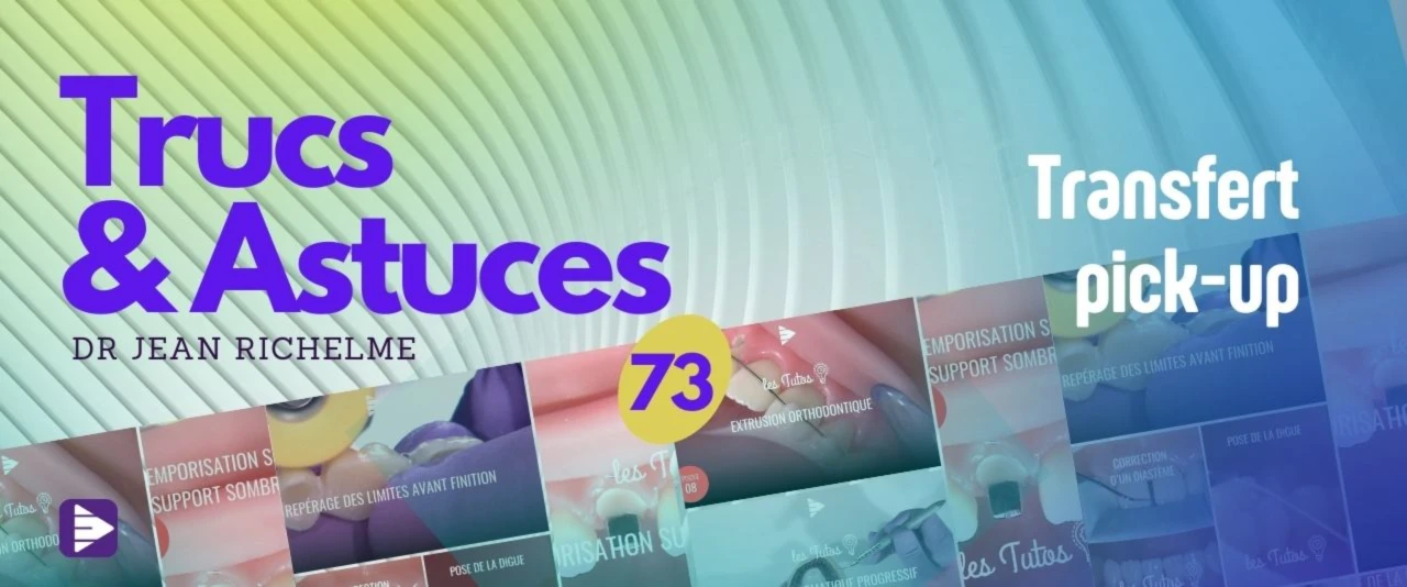 Trucs et astuces : Transfert Pickup
