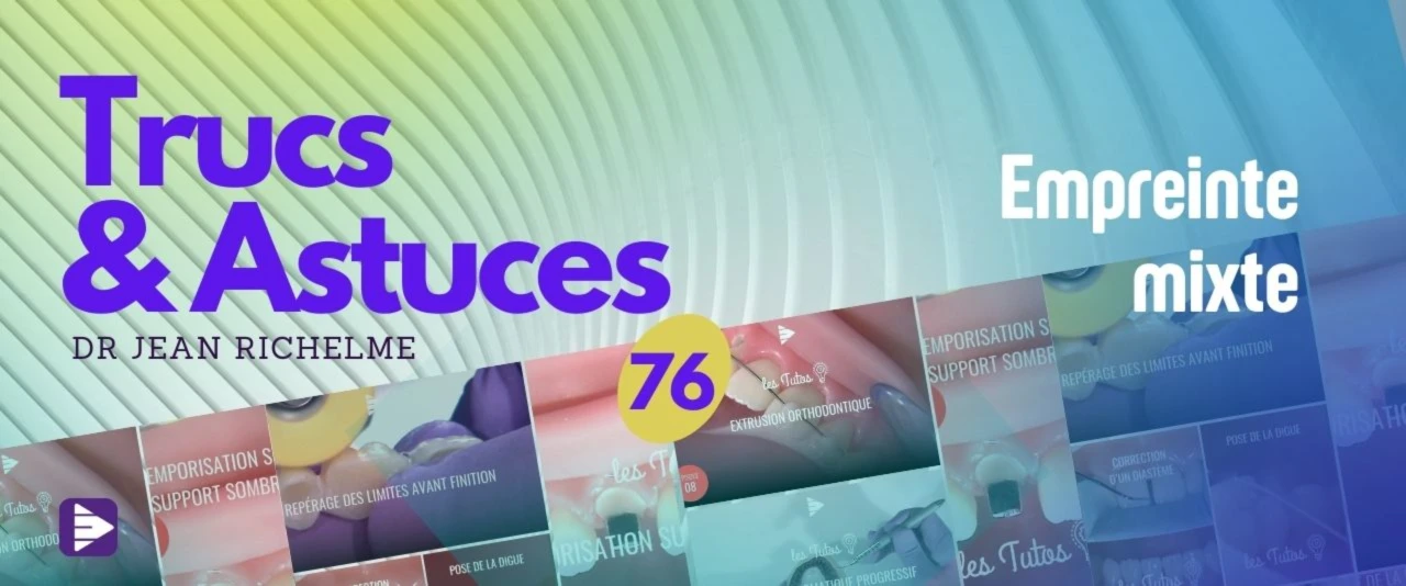 Trucs et astuces : Empreintes mixtes