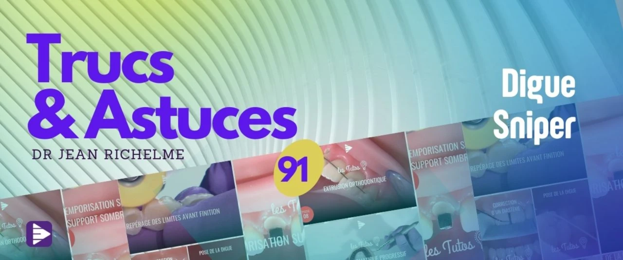 Trucs et astuces : Digue Sniper