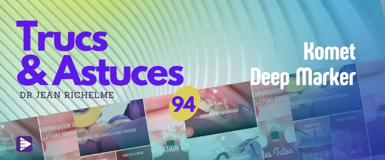 Trucs et astuces : Komet Deep Marker