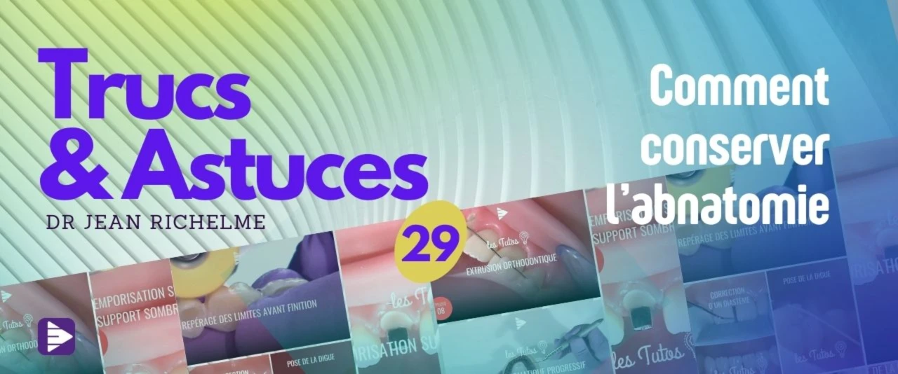 Trucs et astuces : comment conserver l'anatomie ?