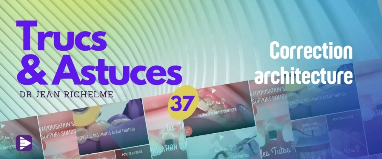 Trucs et astuces : Correction architecture