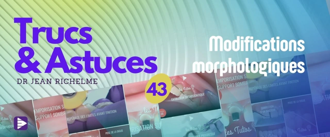 Trucs et astuces : Modification morphologique