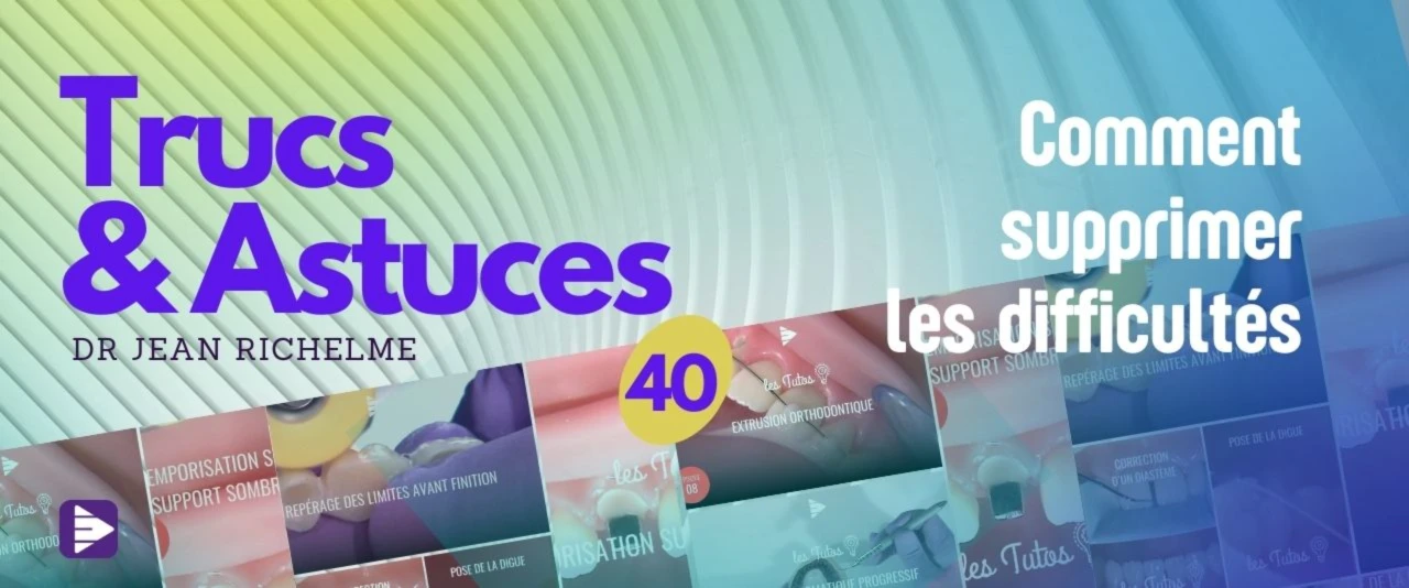 Trucs et astuces : Comment supprimer les difficultés