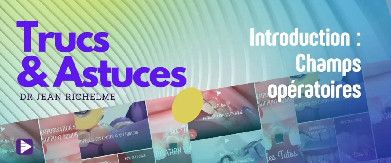 Trucs et astuces : Introduction sur les champs opératoires