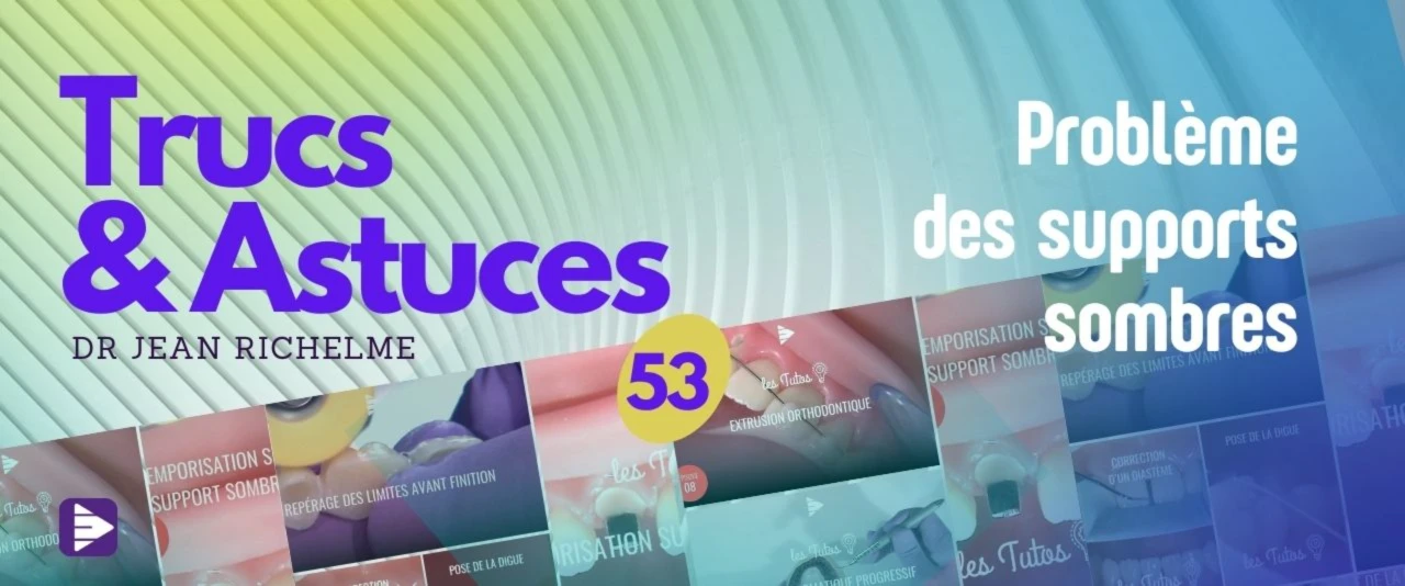 Trucs et astuces : Problèmes supports sombres