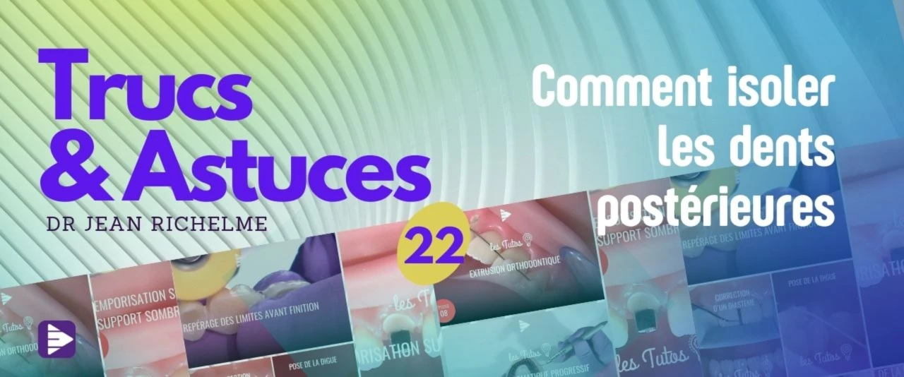 Trucs et astuces : comment isoler les dents postérieures