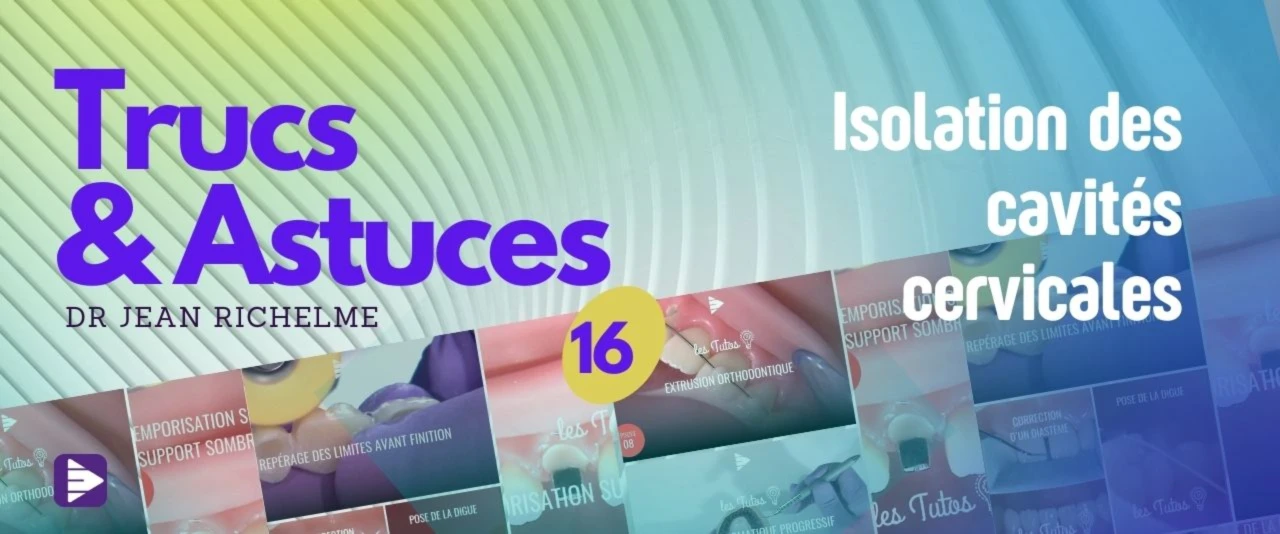 Trucs et astuces : Isolation des cavités cervicales