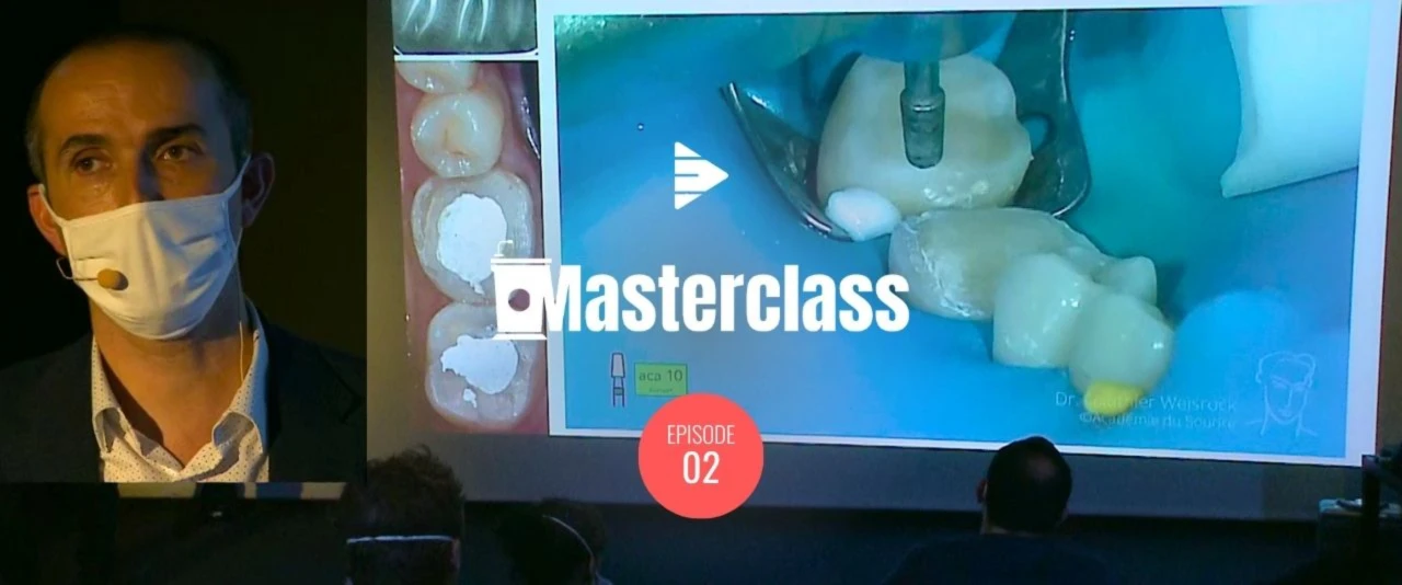 Inlay / Onlay Partie 2