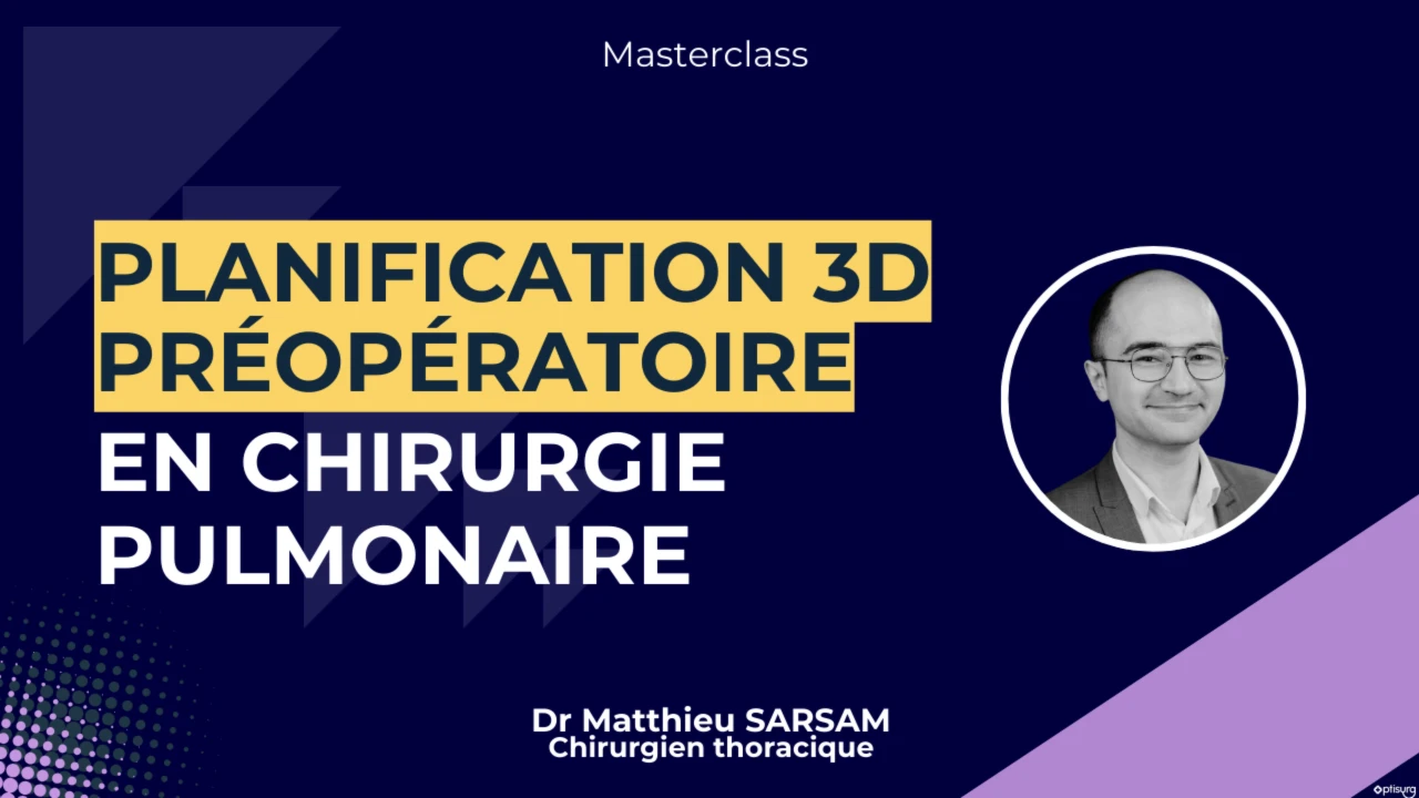 Planification 3D préopératoire en chirurgie thoracique