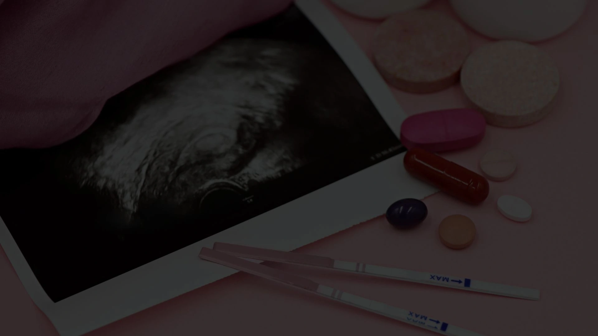 Infertilité : l'accompagnement émotionnel qui change tout