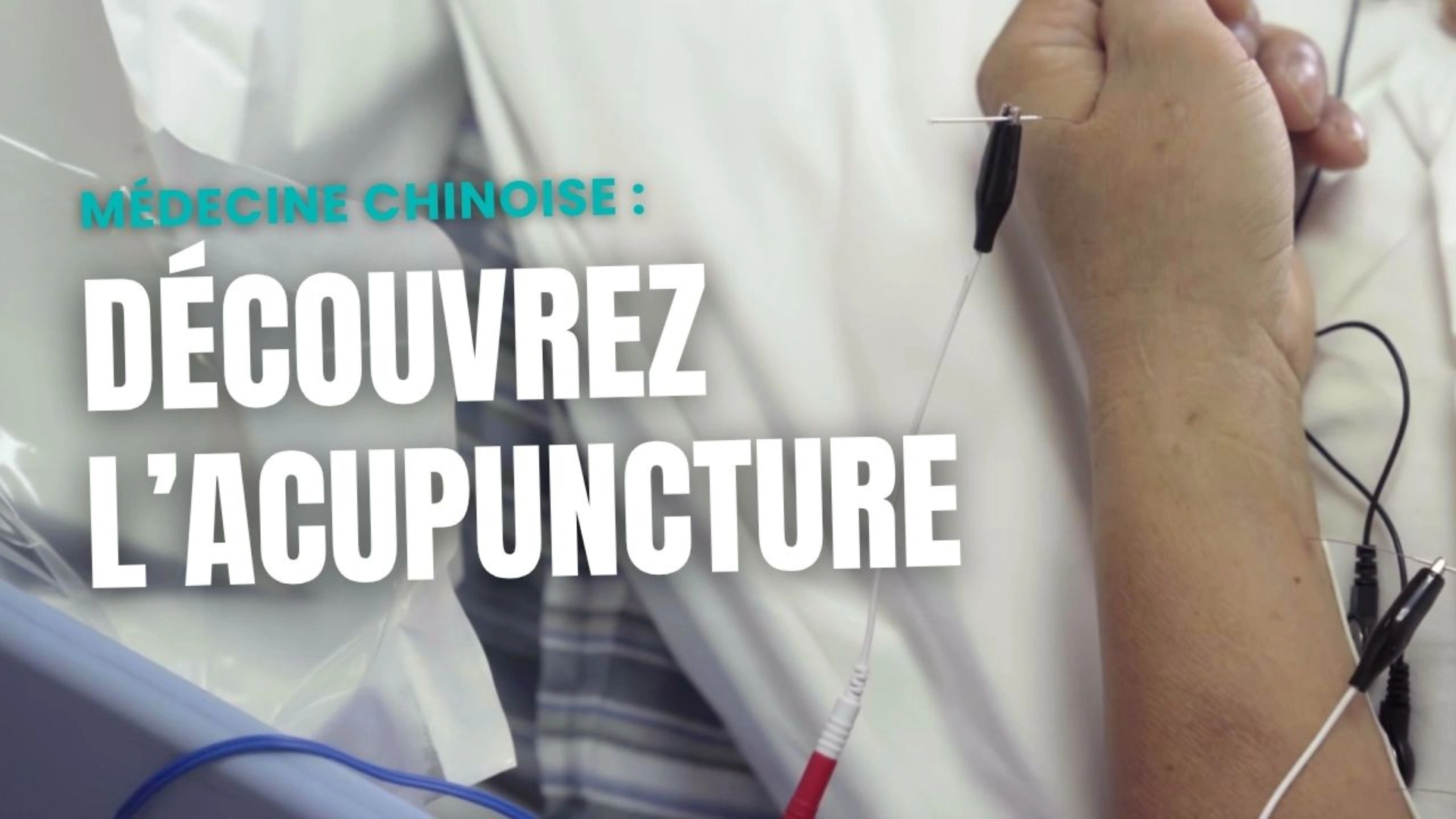 Découvrez l'acupuncture