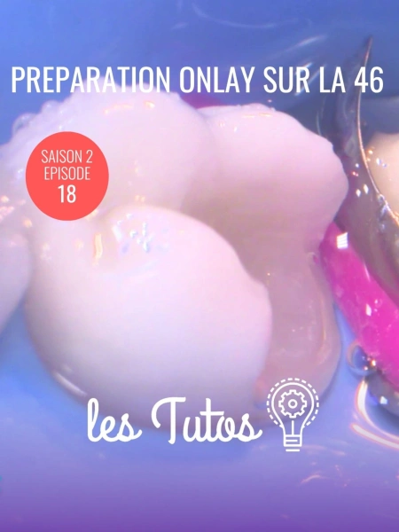 Préparation d'un Onlay sur la 46
