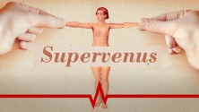 Supervenus