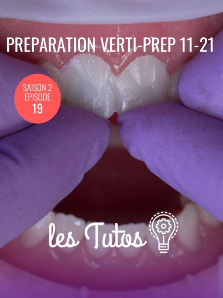 Cette semaine : Préparation Verti‑Prep 11‑21