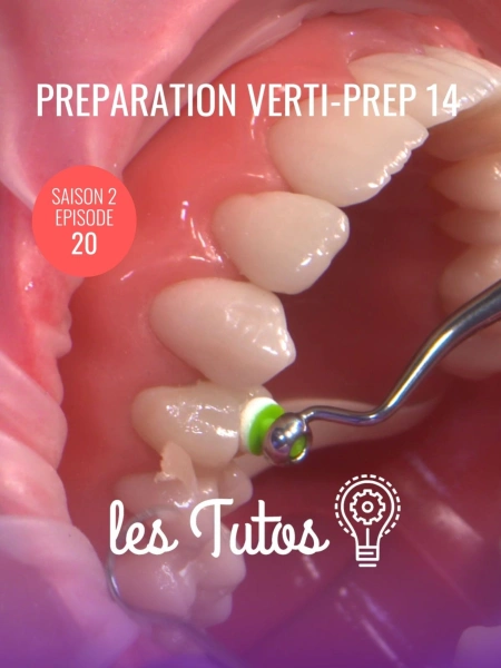 Préparation Verti-Prep 14