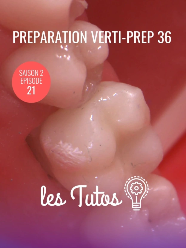 Préparation Verti-Prep 36