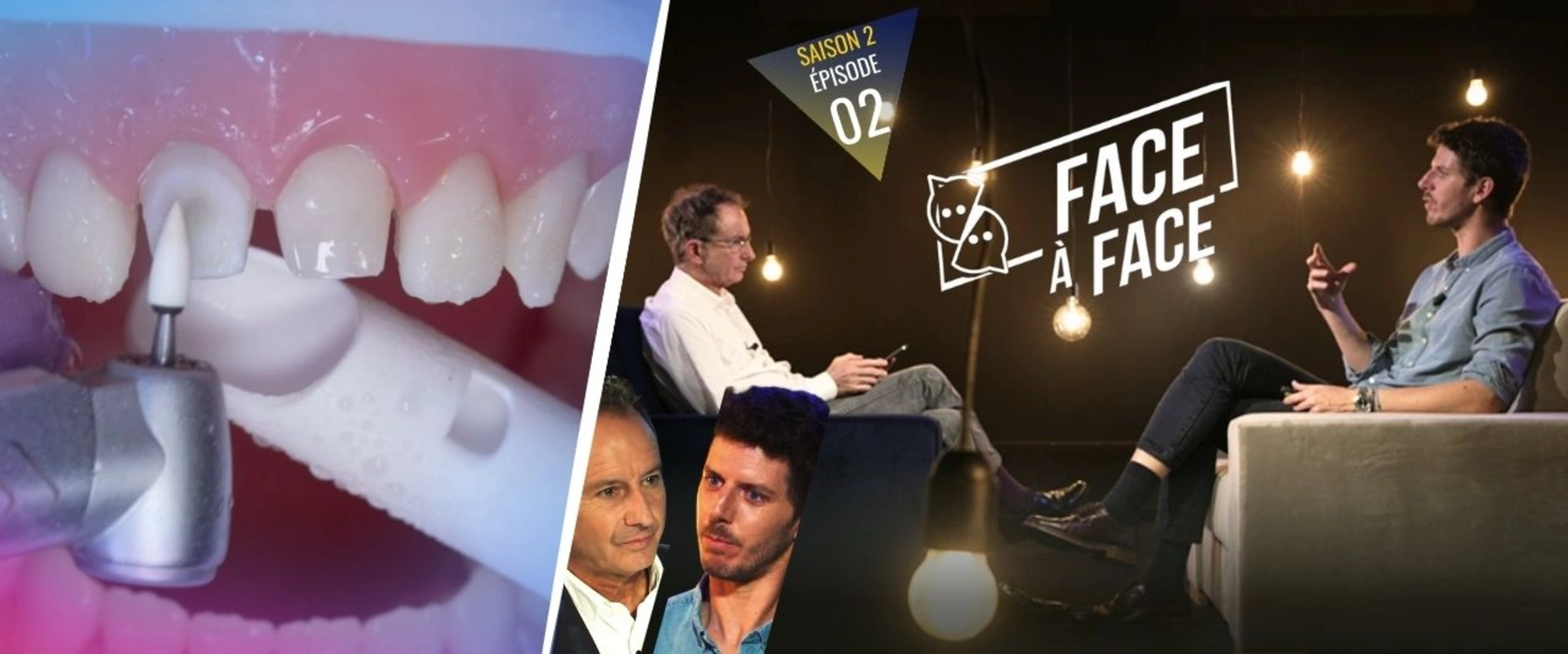 Pourquoi réaliser des vertipreps ?