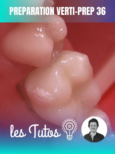 Préparation Verti-Prep 36