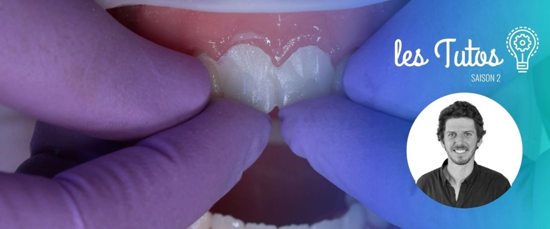 Préparation Verti‑Prep 11‑21