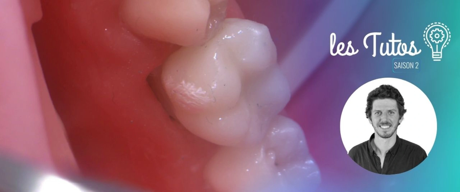 Cette semaine : Préparation Verti-Prep 36