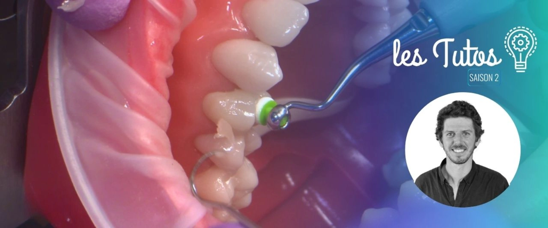 Cette semaine : Préparation Verti-Prep 14