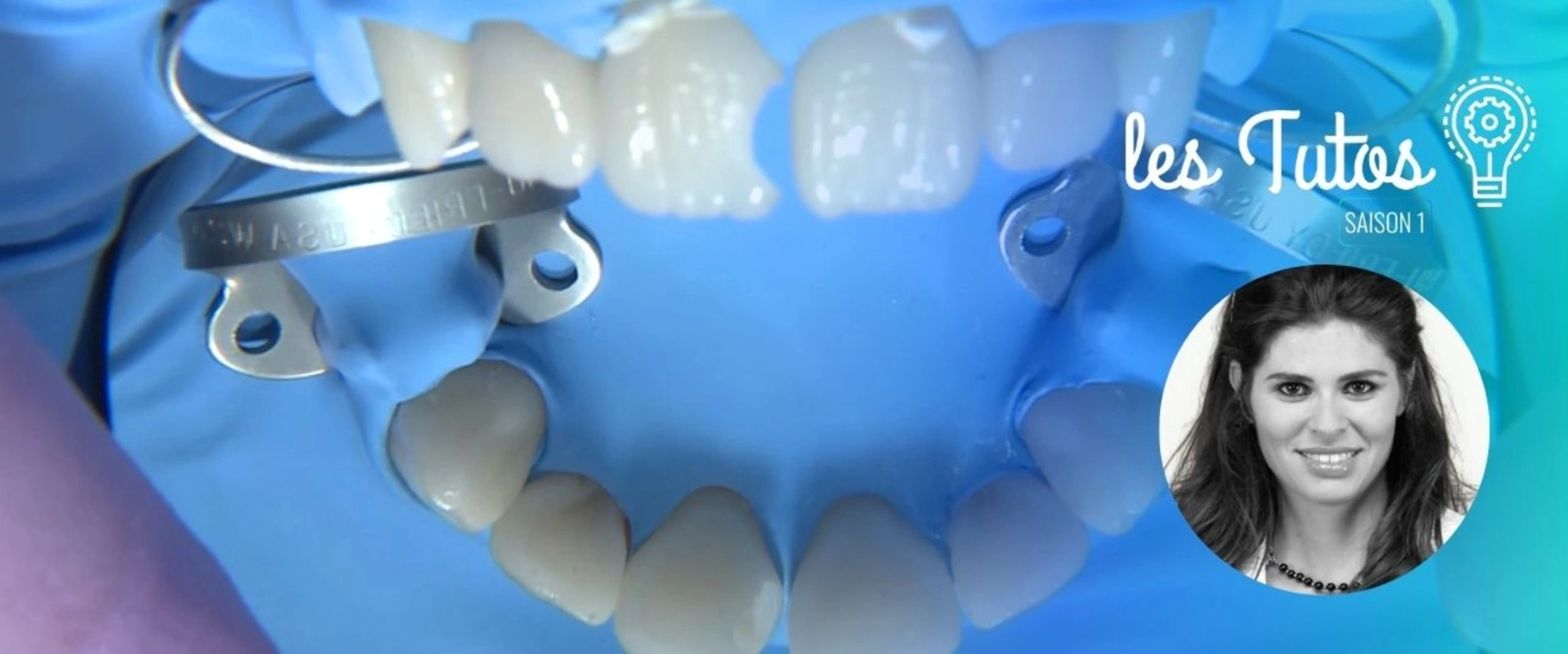 Restauration de classe III