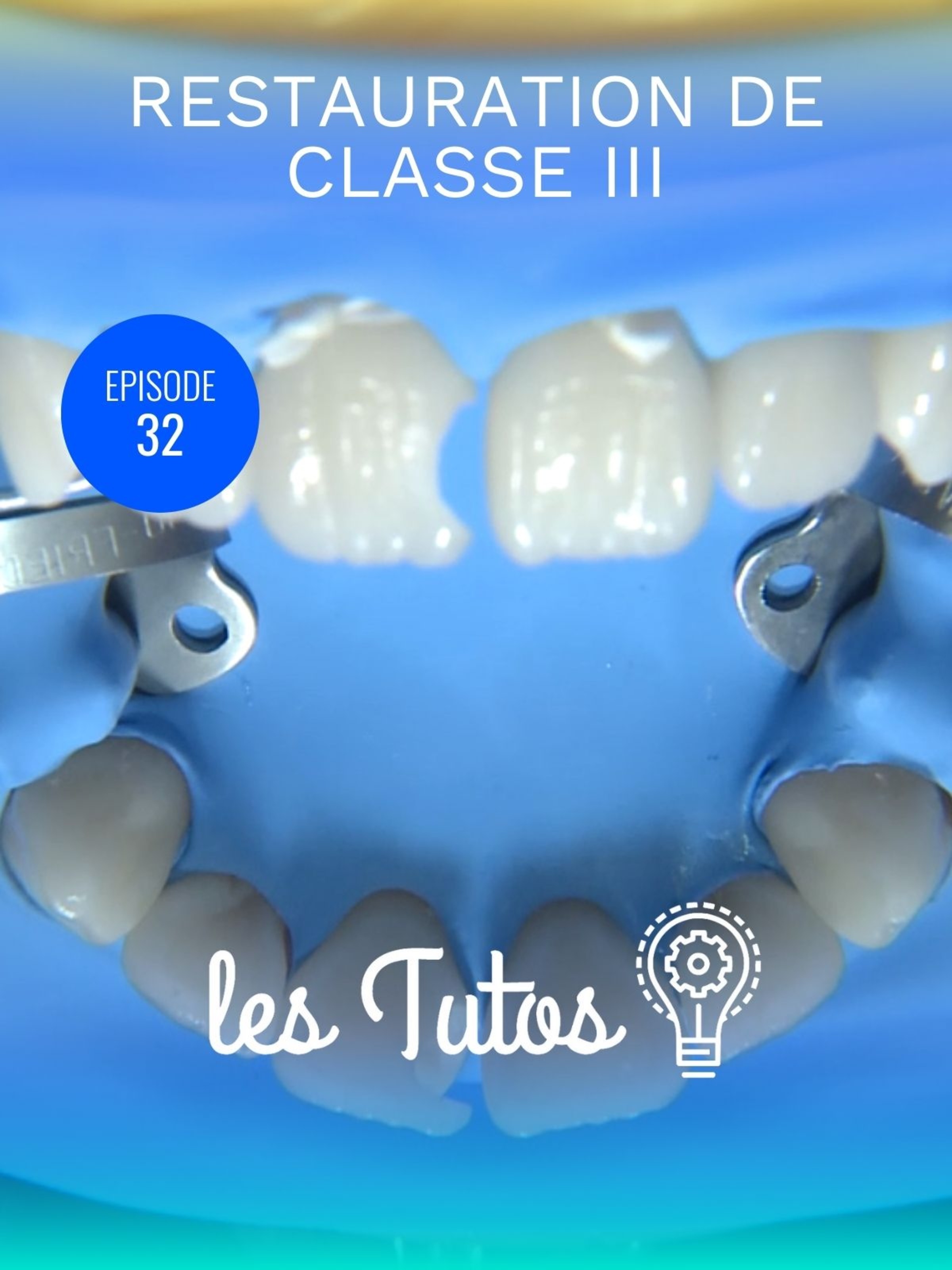 Restauration de classe III