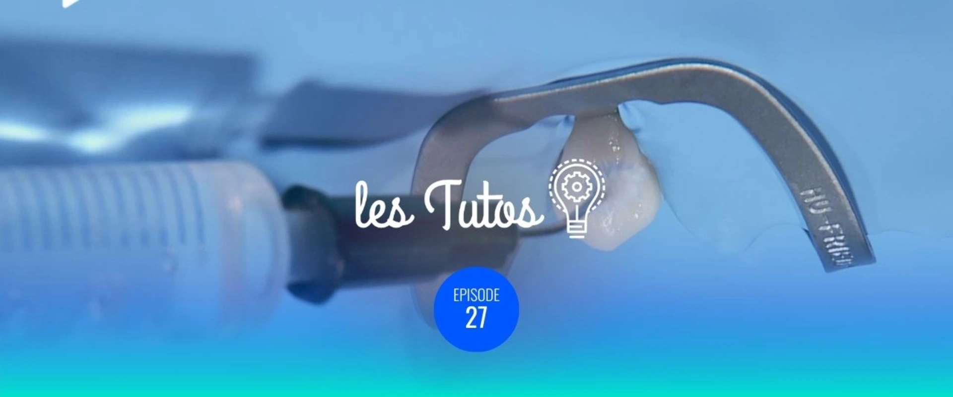 Restauration des lésions des collets (Classe V)