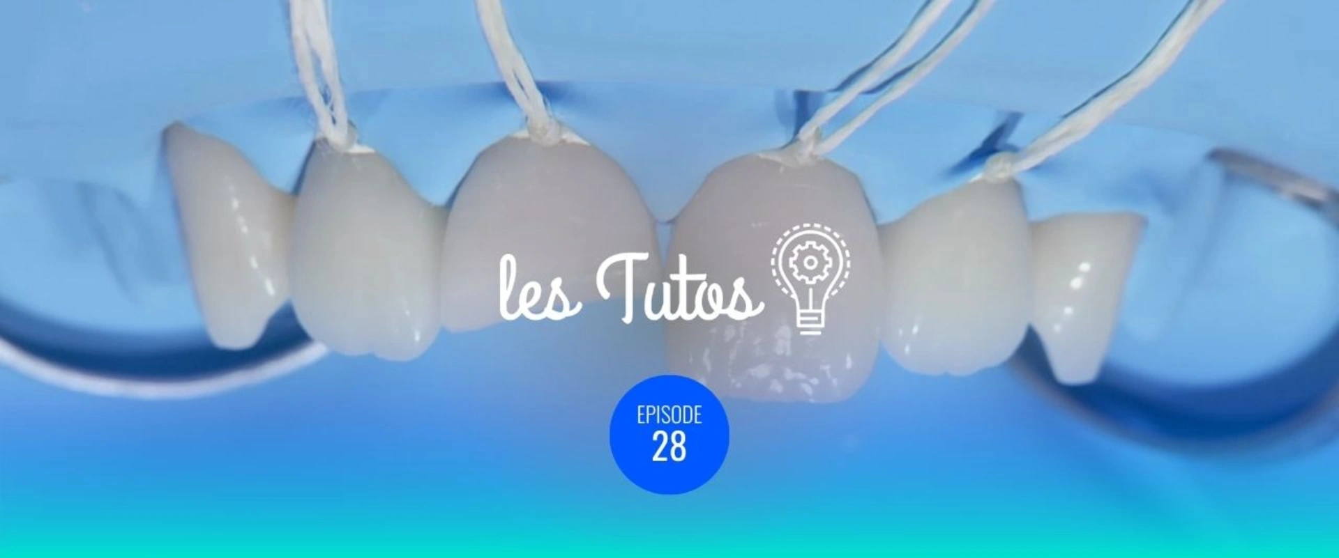 Restauration de classe 4