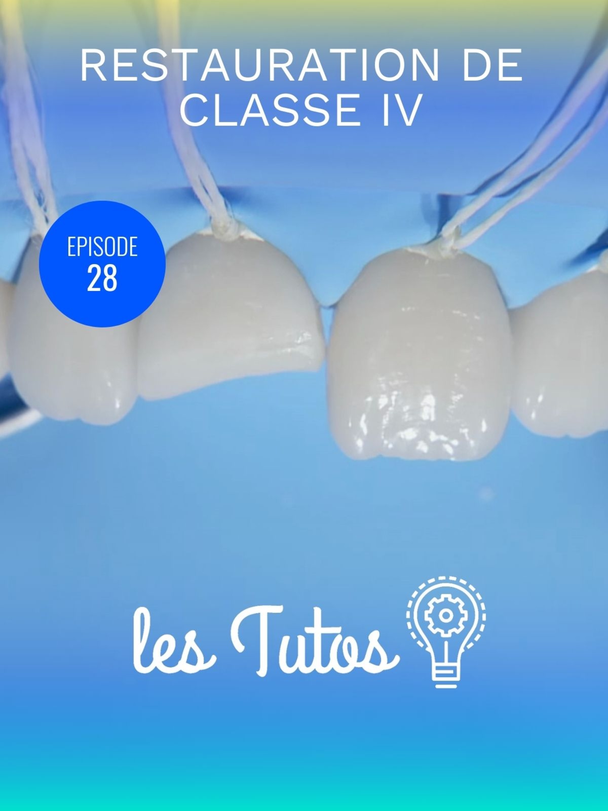 Restauration de classe 4
