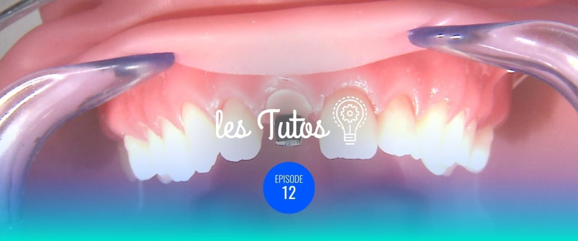 Temporisation sur support sombre