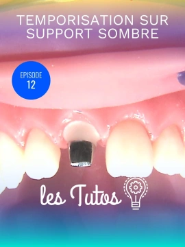 Temporisation sur support sombre