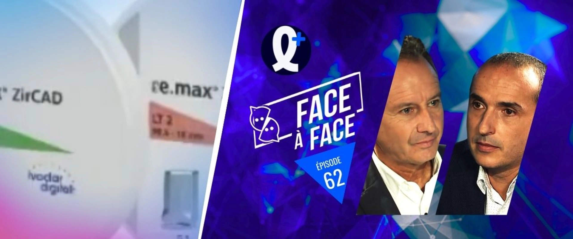 Inlays-Onlays : Quel type de RPC sur les postérieures ?