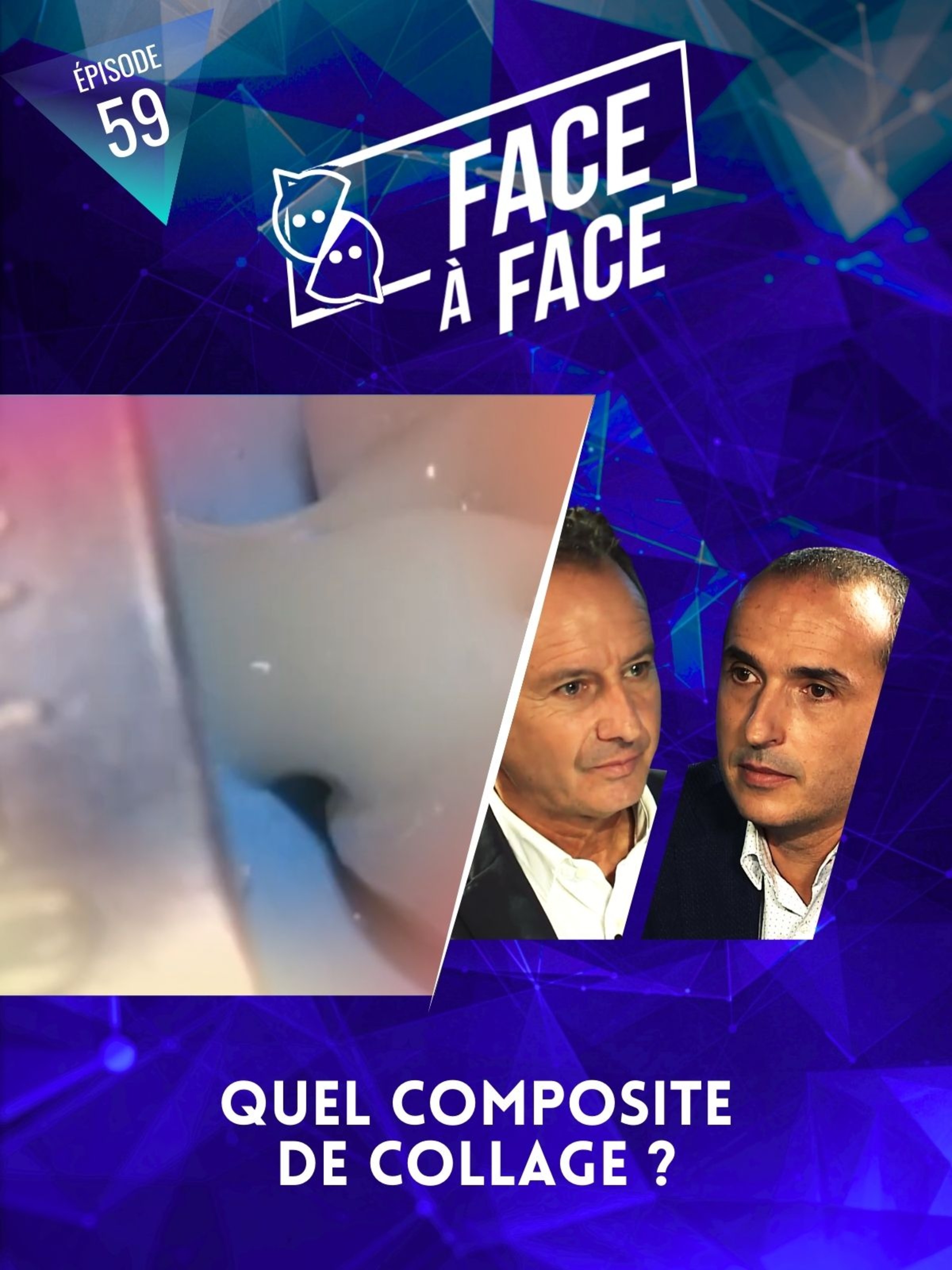 Inlays-Onlays : Quel composite de collage?
