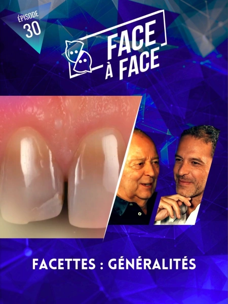 Facettes : Généralités