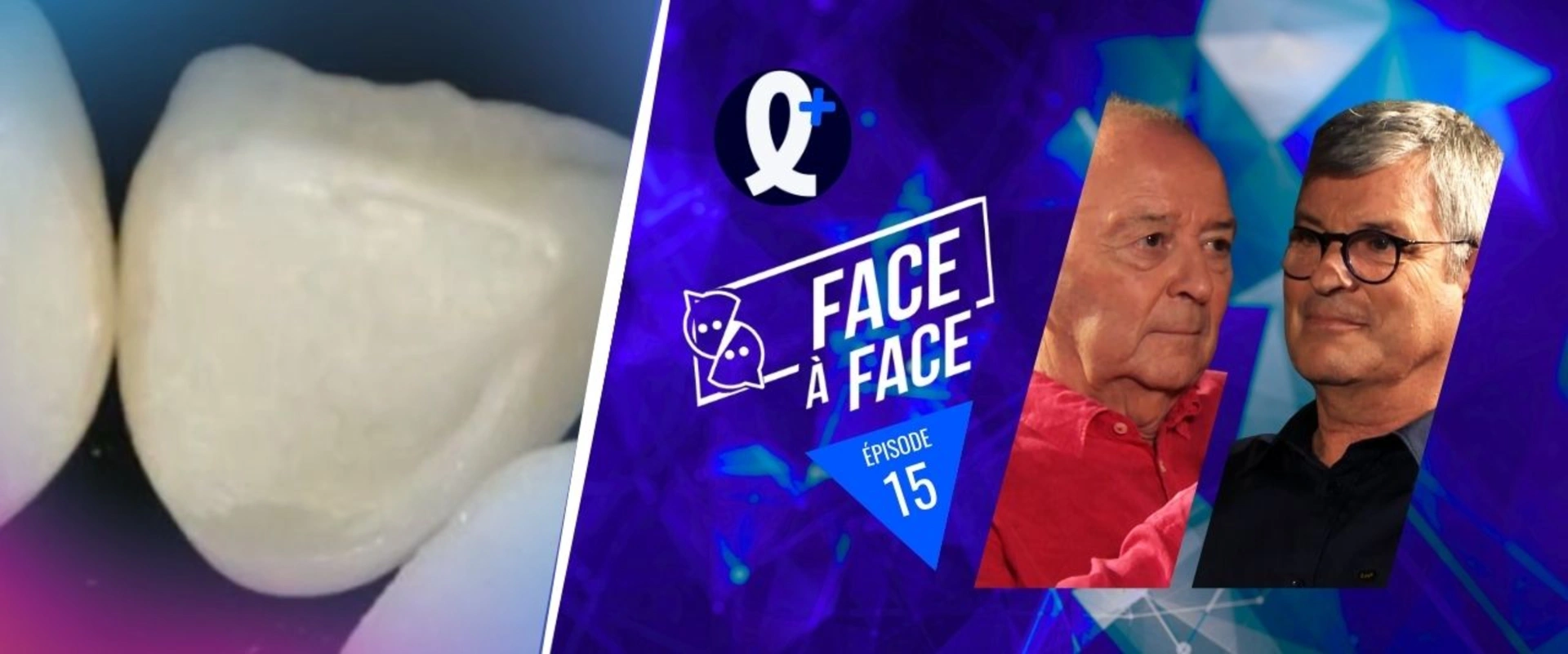 Les vitro-céramiques