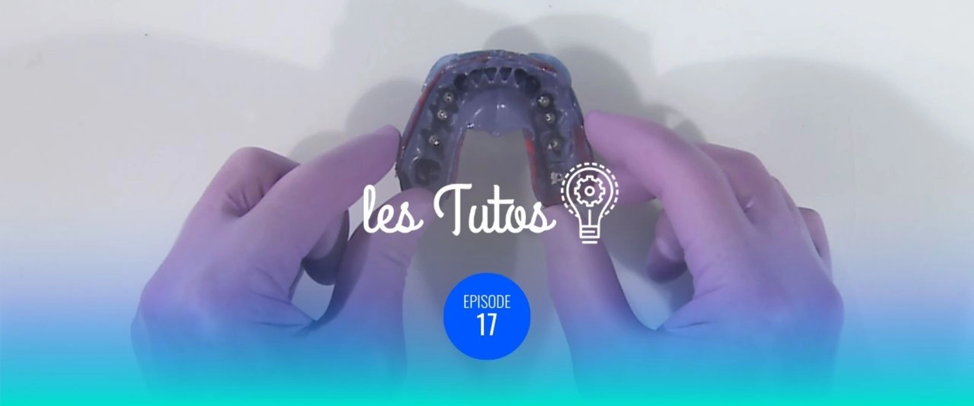 Empreinte mixte silicone / plâtre