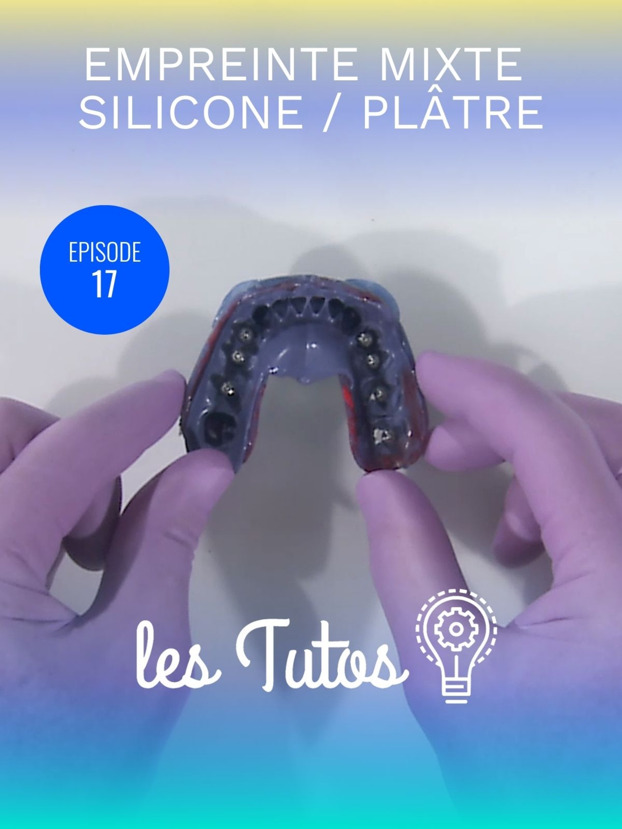 Empreinte mixte silicone / plâtre