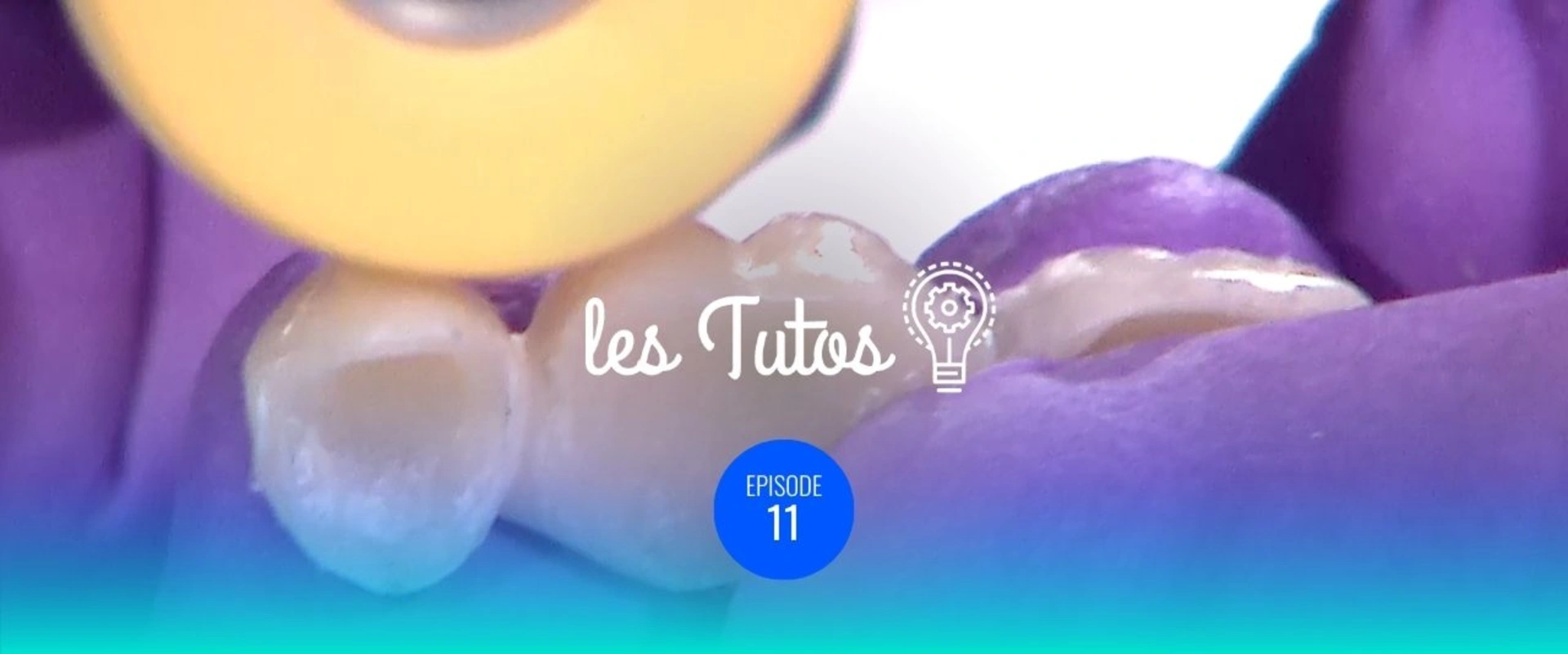 Repérage des limites avant finition