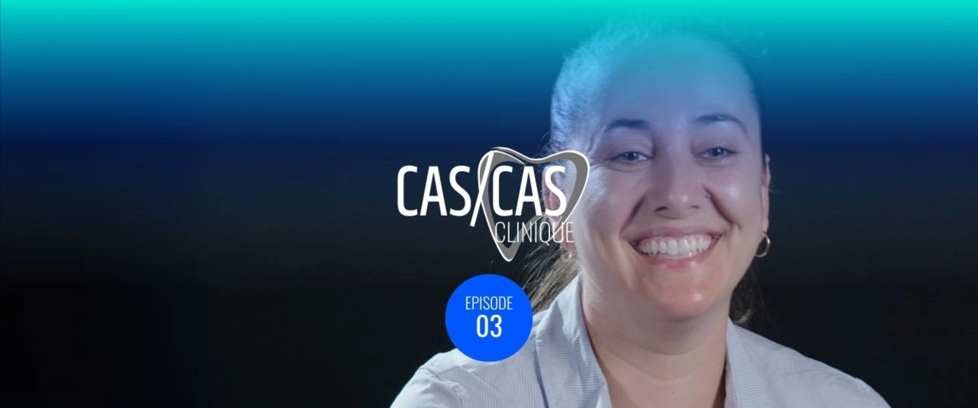 Facette unitaire en cas de dyschromie Partie 3 : Feedback