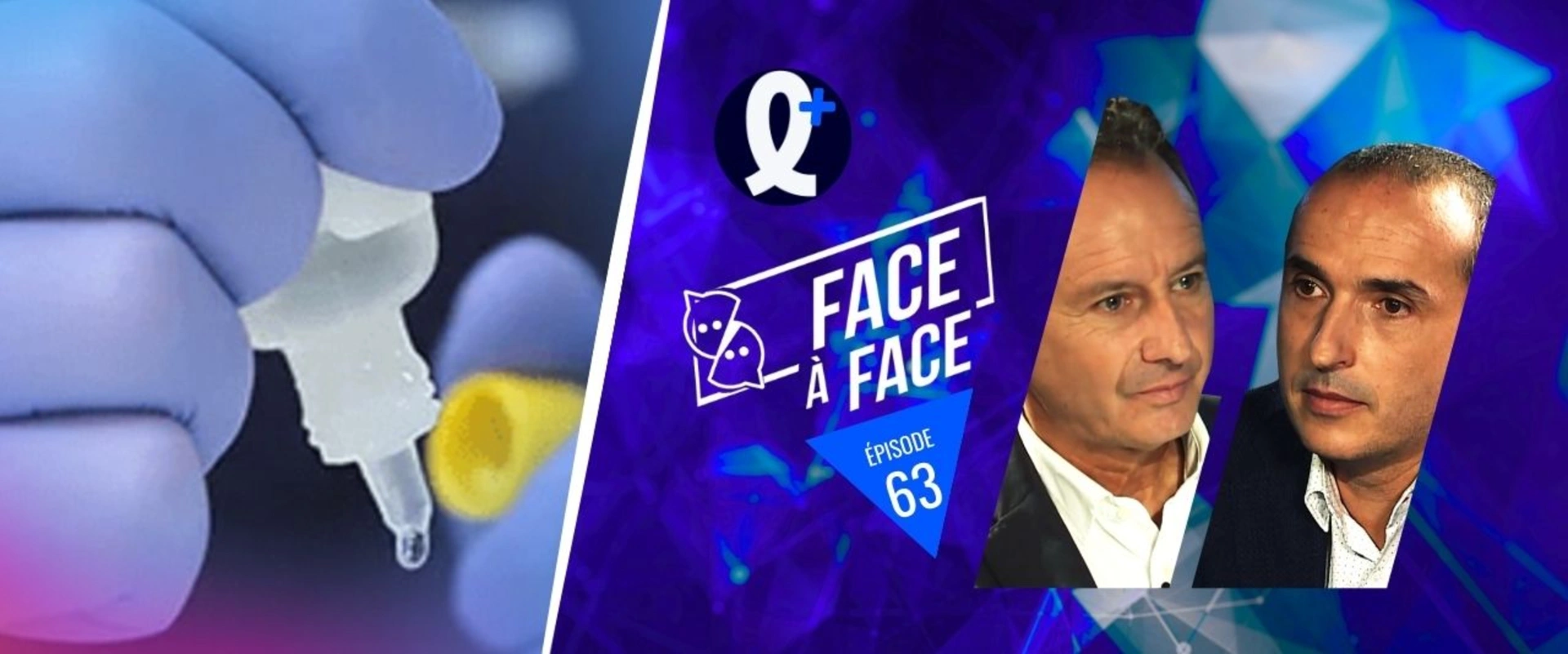 Inlays- Onlays : collage RPC