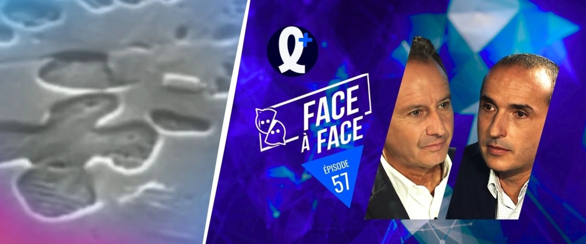 Inlays-Onlays : matériaux pour RPC